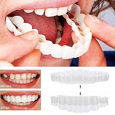 Braces Instant Perfect Veneers Dentures Fake Teeth Smile Serrated Denture Teeth Top and Bottom Comfort Fit Flex Teeth Socket to Make White Tooth Beautiful Neat